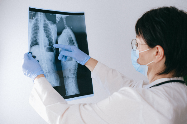 La COVID-19 érige de nouveaux obstacles au traitement et à la prise en charge du cancer du poumon au Canada