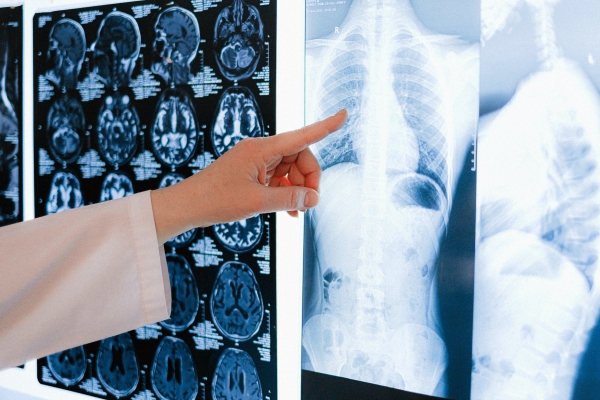 Les radiologistes se rendent sur la Colline du Parlement pour demander que des mesures soient prises afin d'éliminer l'arriéré de demandes d'imagerie médicale au Canada