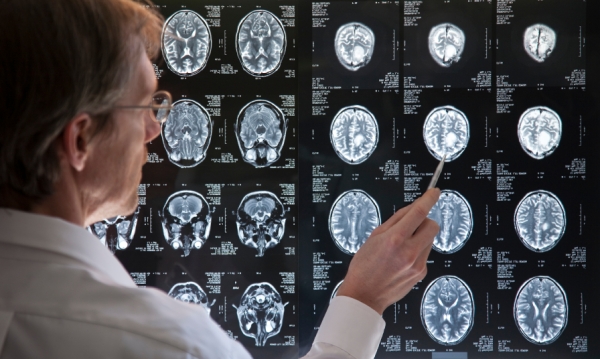 L’Association canadienne des radiologistes réclame un investissement fédéral pour améliorer l’accès à l’imagerie diagnostique
