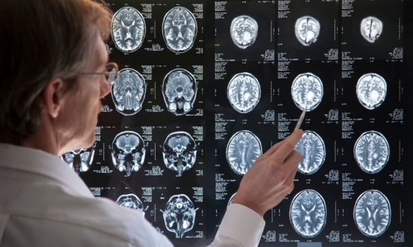 L'intelligence artificielle fait progresser la radiologie au Canada