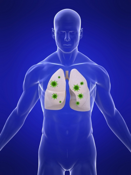 Les maladies pulmonaires graves causées par le tabagisme : deux fois plus meurtrières que le cancer du poumon